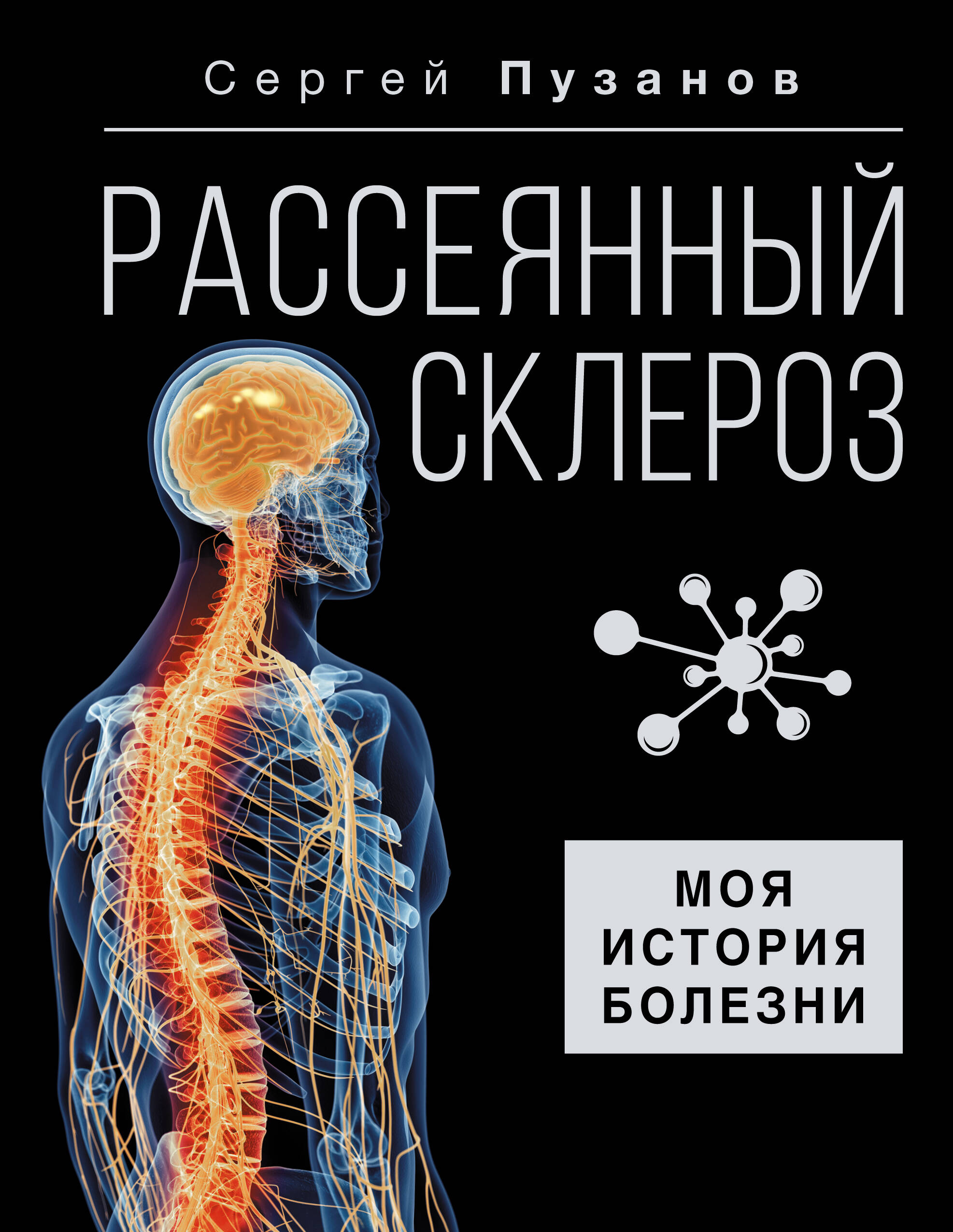 Пузанов Сергей Игоревич Рассеянный склероз. Моя история болезни - страница 0
