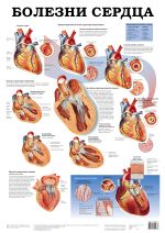 Болезни сердца. Болезни мочевых органов