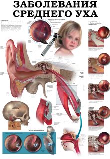 Обычная простуда. Заболевания среднего уха