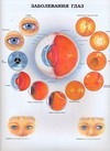 Заболевания глаз. Анатомия пищеварительной системы и болезни желудка и пищевода